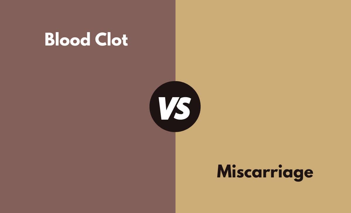 Blood Clot Vs Miscarriage What s The Difference With Table 